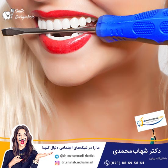 آیا ایمپلنت های دندانی پوسیده و خراب می شوند؟ - کلینیک دندانپزشکی دکتر شهاب محمدی