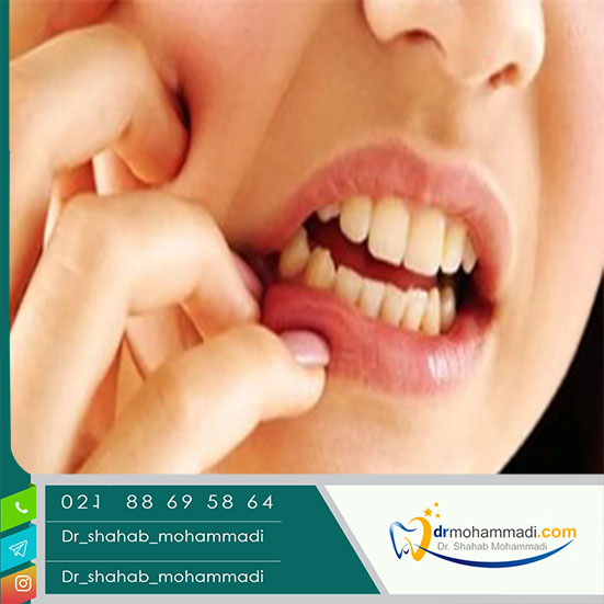 تومور در دهان و یا استخوان‌های فک چگونه است؟  