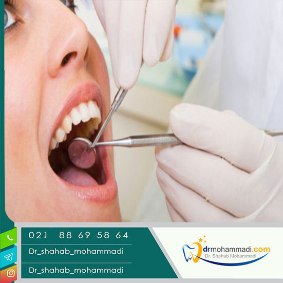 درصد موفقیت ایمپلنت دندان چقدر است؟ - کلینیک دندانپزشکی دکتر شهاب محمدی