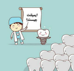 نکاتی که قبل از عمل ایمپلنت باید بدانیم - کلینیک دندانپزشکی دکتر شهاب محمدی