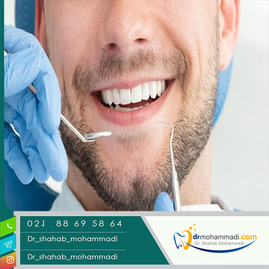 بعد از کامپوزیت دندان تا چند روز نمی توانیم سیگار بکشیم؟ - کلینیک دندانپزشکی دکتر شهاب محمدی