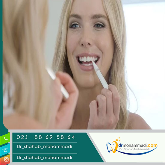 مزایا و معایب لاک سفید کننده دندان - کلینیک دندانپزشکی دکتر شهاب محمدی