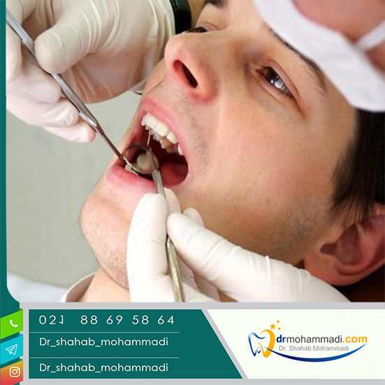 اینتروژن دندان چیست؟