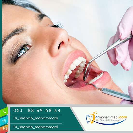 آیا می توان بعد از کشیدن دندان، بلافاصله ایمپلنت فوری انجام داد؟ - کلینیک دندانپزشکی دکتر شهاب محمدی