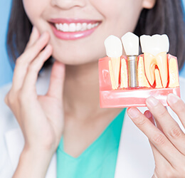 کاربرد کاشت ایمپلنت دندان در دندانپزشکی - کلینیک دندانپزشکی دکتر شهاب محمدی