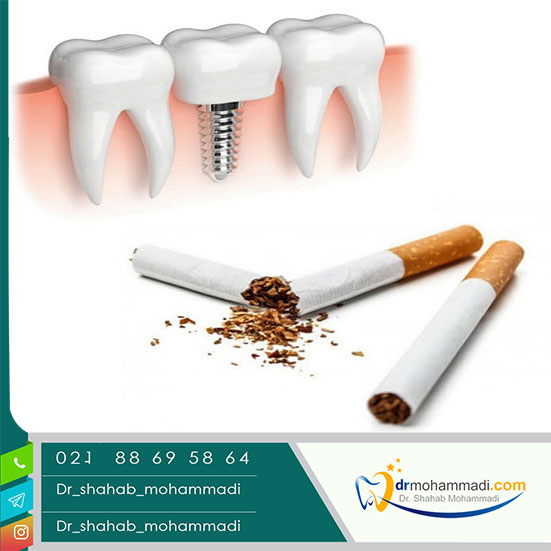 تاثیر سیگار کشیدن روی ایمپلنت های دندانی - کلینیک دندانپزشکی دکتر شهاب محمدی