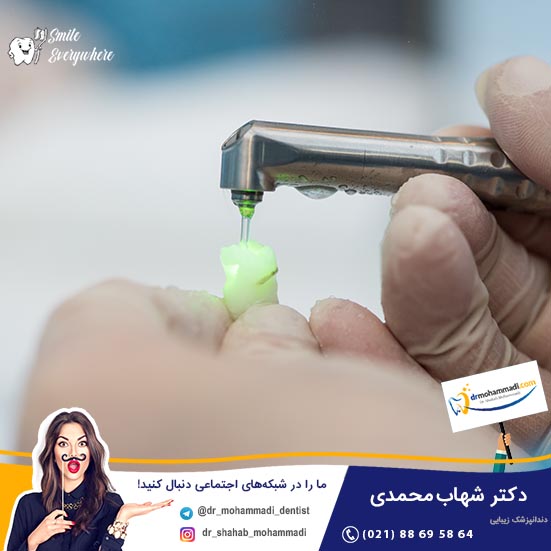 نقش لیزر در جراحی ایمپلنت دندان چیست؟ - کلینیک دندانپزشکی دکتر شهاب محمدی
