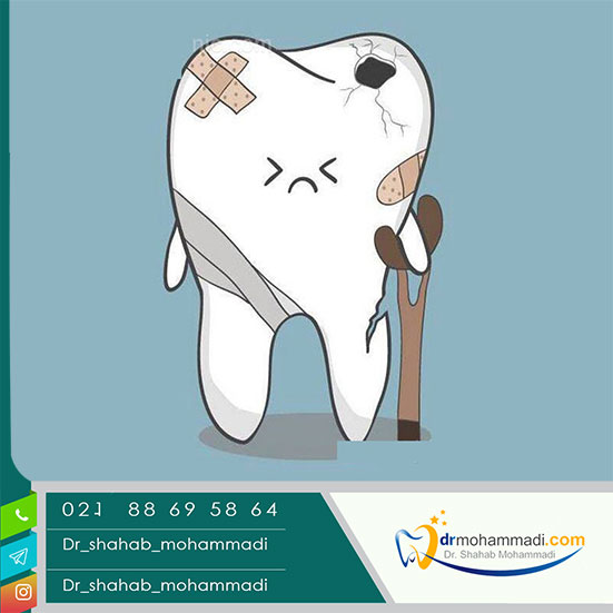 Diagnosis of tooth fracture