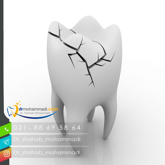 نشانه های سندروم ترک دندان