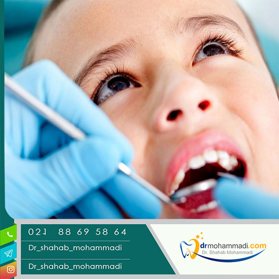 Common dental problems in children