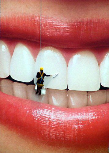 سفید کردن دندان