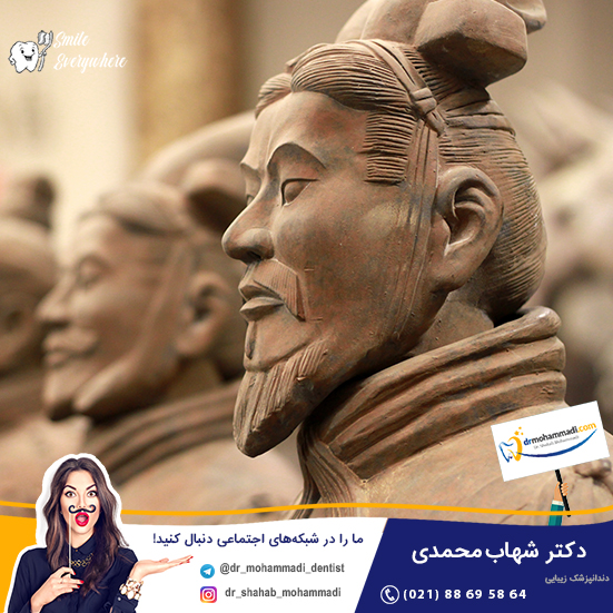ایمپلنت در چین باستان