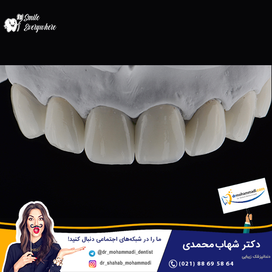 تاج دندان چیست و انواع تاج و روش های مراقبت آن کدامند؟